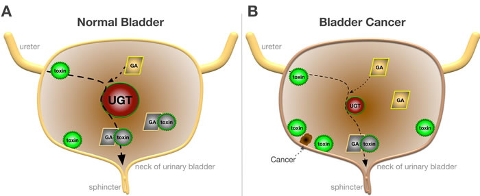 Function of UGT in Normal and Bladder Cancer.