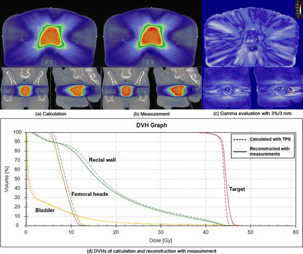 A prostate volumetric modulated arc therapy (VMAT) example of quasi-3D gamma evaluation with a gamma criterion of 3%/3 mm using the COMPASS system is shown.