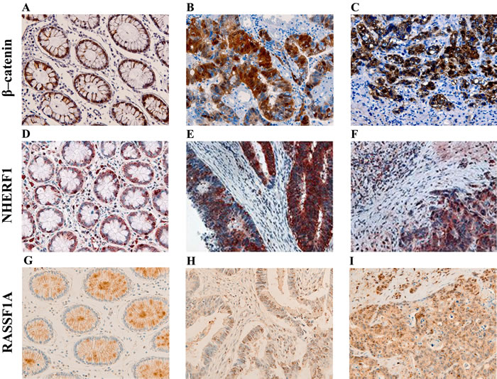 Representative images of the immunoreactivity of &#x3b2;-catenin, NHERF1 and RASSF1A.