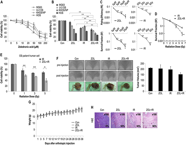 The radiosensitizing effects of zoledronic acid (ZOL) on osteosarcoma (OS) cells treated with irradiation.