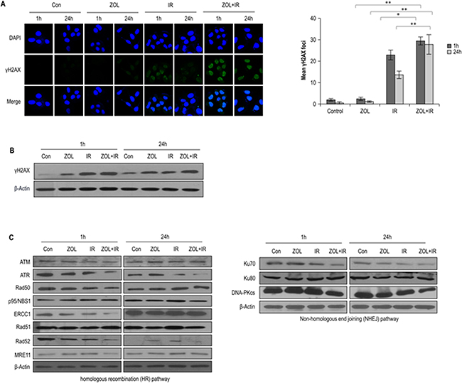 Effects of ZOL on the DNA damage response in irradiated OS cells.