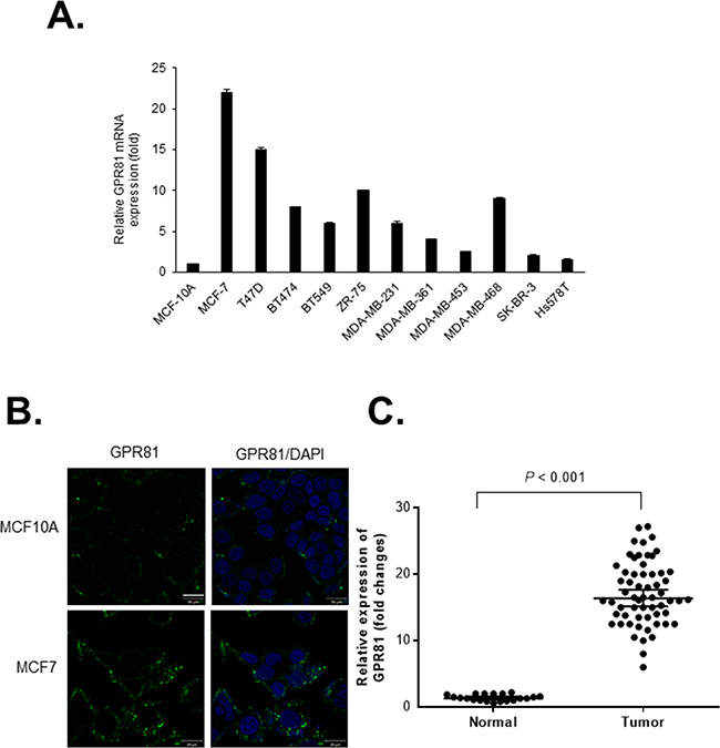 GPR81 is highly expressed in breast cancer.