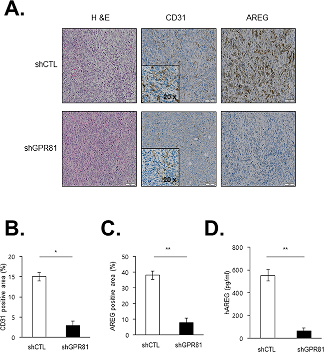 Effects of GPR81 silencing on angiogenesis in an orthotopic breast cancer model.