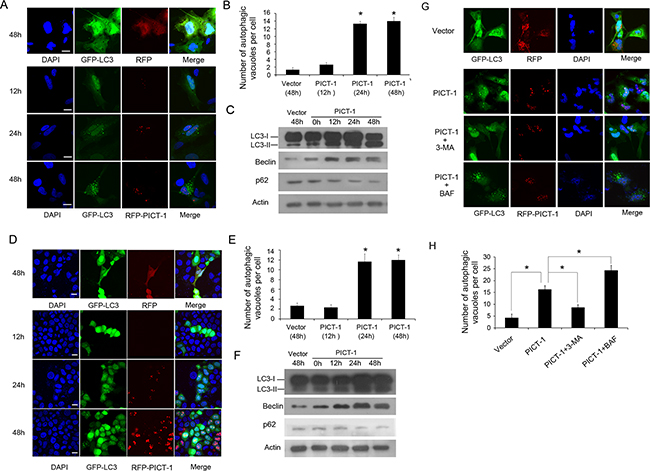 PICT-1 overexpression triggers autophagy in U251 and MCF7 cells.