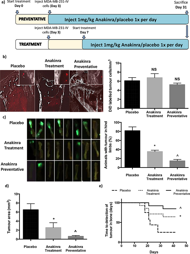 Effects of anakinra on MDA-MB-231 breast cancer dissemination and growth in bone.