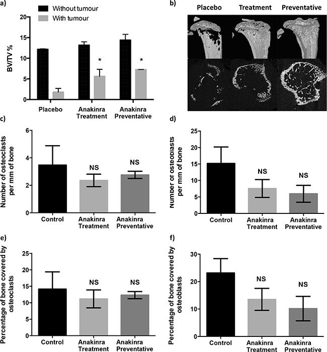 Effects of continuous IL-1R inhibition with anakinra on bone.