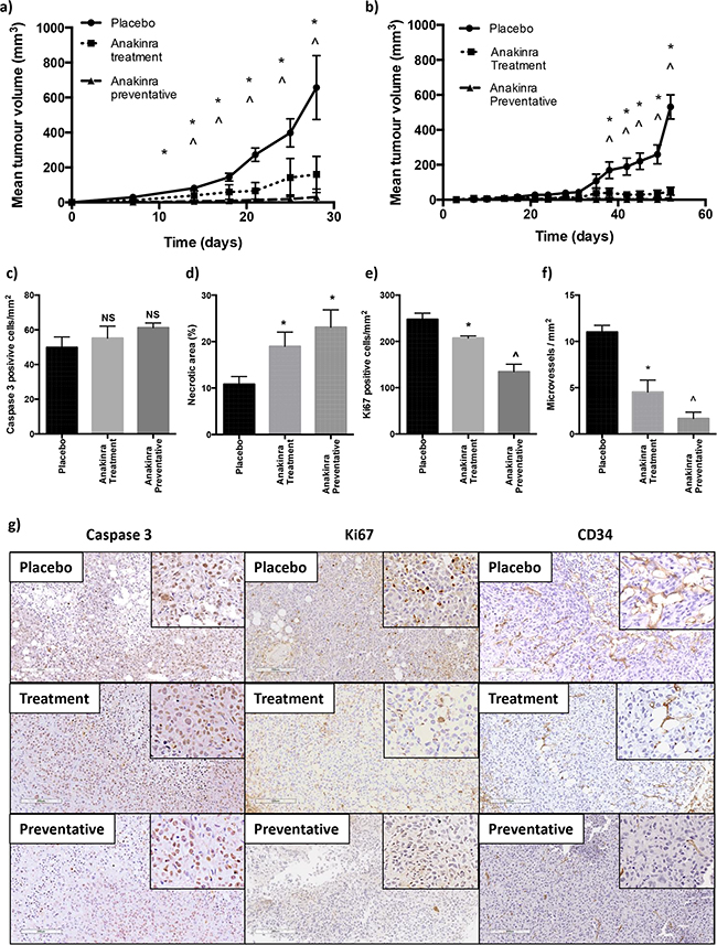 Effects of anakinra on subcutaneous MDA-MB-231-IV and MCF7 tumours.