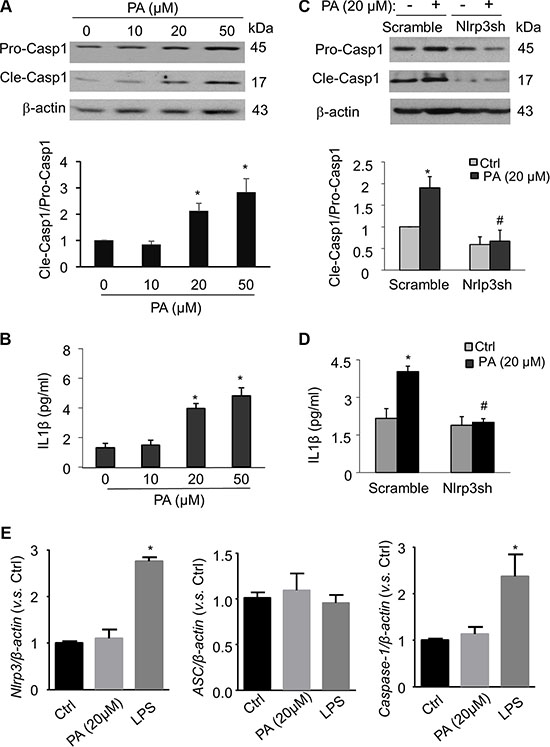 Palmitate activates Nlrp3 inflammasomes in MVECs.
