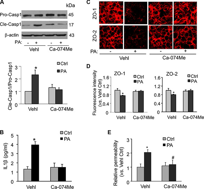 Inhibition of cathepsin B activity abolishes palmitate-induced Nlrp3 inflammasome activation, tight junction disruption, and enhanced permeability in MVECs.