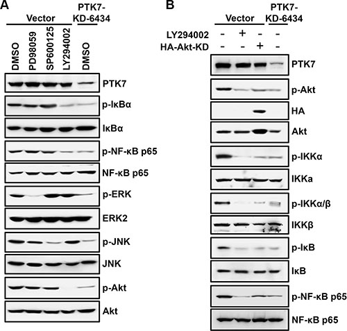 Effect of signaling blockade on the PTK7-mediated NF-&#x03BA;B activation in TE-10 cells.