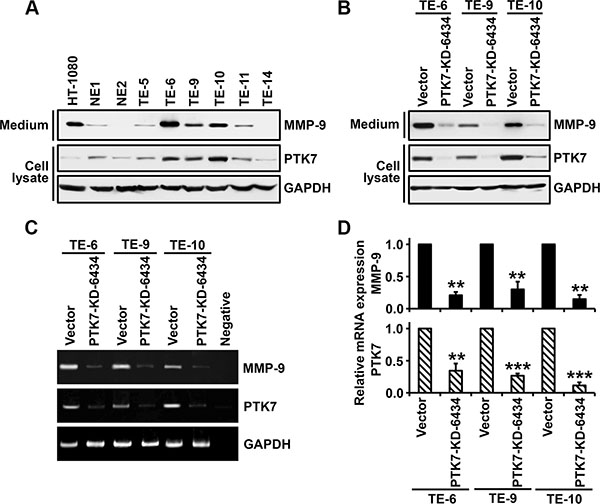 Analysis of PTK7-dependent MMP-9 expression in esophageal epithelial and ESCC cell lines.