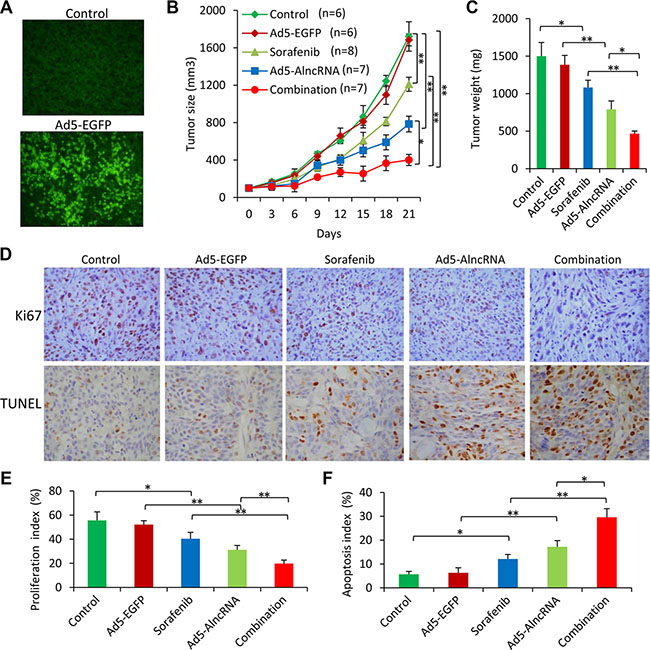 AlncRNA enhances the efficacy of sorafenib to suppress sorafenib-resistant tumors in vivo.