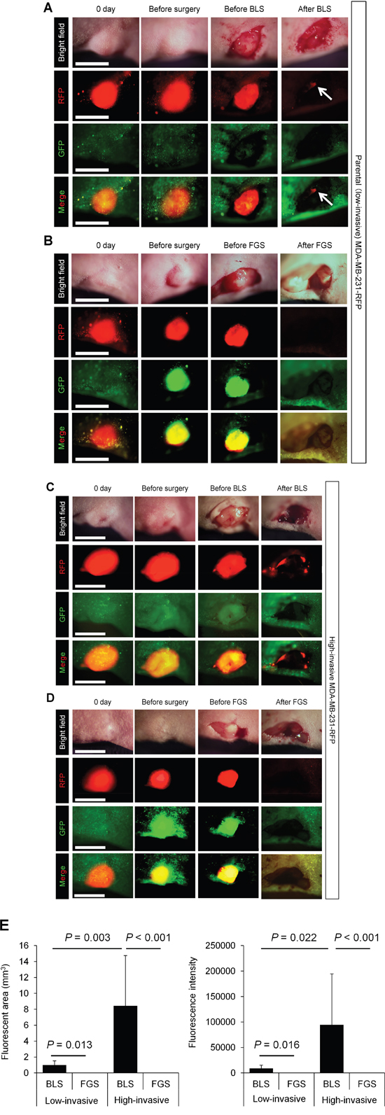 Comparison of OBP-401-based fluorescence-guided surgery with bright-light surgery for orthotopic low- and high-invasive MDA-MB-231-RFP.