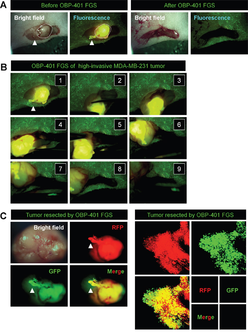 In situ OBP-401 GFP-labeling visualizes invading cancer cells and enables complete resection of high-invasive MDA-MB-231-RFP.