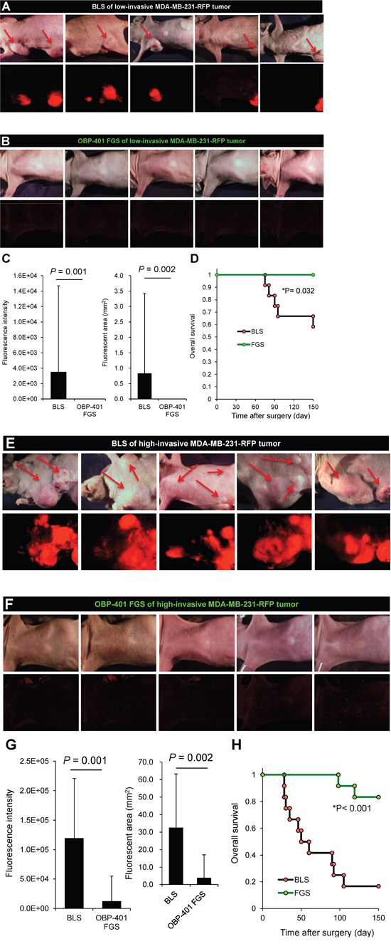 OBP-401-based FGS inhibits metastatic recurrence.