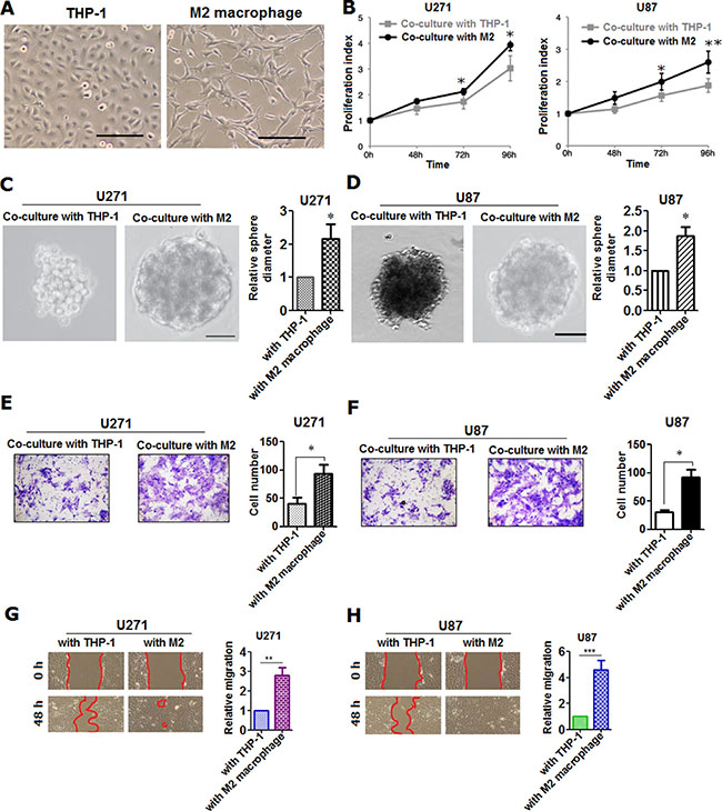 M2 macrophage was shown to be able to promote the proliferation, invasion and migration of glioma cells.