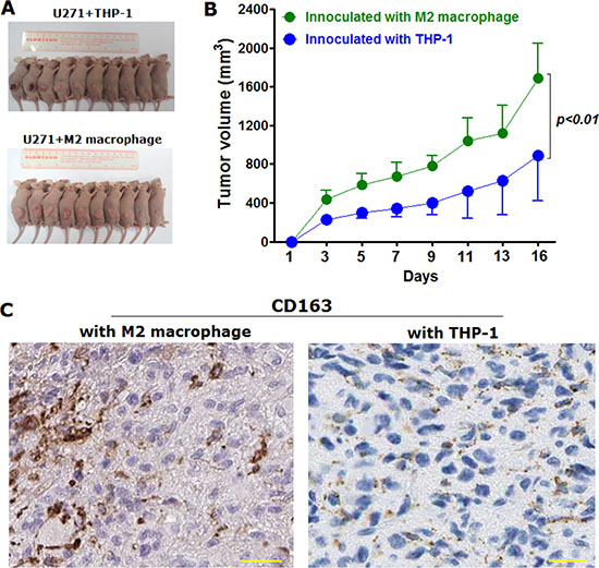 M2 macrophage was displayed to be capable of promoting tumor growth in vivo in nude mice xenografted with U271 cells mingled with M2 macrophages or THP-1 cells, respectively.