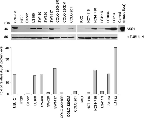 ASS1 expression in human CRC cell lines.