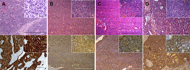 Histology of the patient and mouse-grown tumors and metastasis.