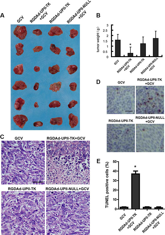 The effect of RGDAd-UPII-TK infection on T24 implanted tumors in nude mice.