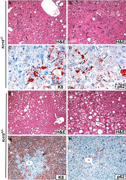 Light microscopy (H&#x0026;E staining) and immunohistochemistry of livers of aged Krt18&#x2212;/&#x2212; (A&#x2013;D) and Krt18+/&#x2212; (E&#x2013;H) male mice.