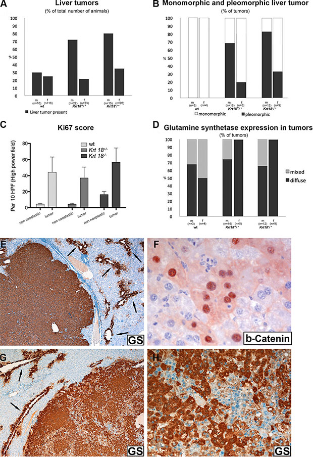 Histopathological characterization of liver tumors of 17-20-months-old wt, Krt18+/&#x2212; and Krt18&#x2212;/&#x2212;mice.