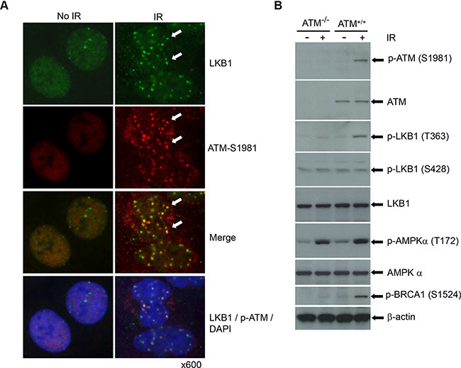 LKB1 is phosphorylated by and co-localizes with ATM.