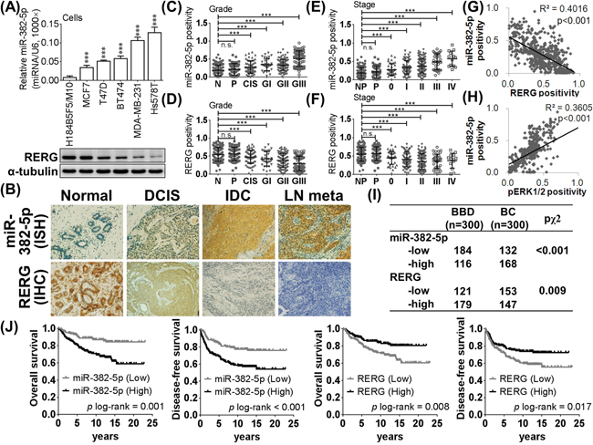 MiR-382-5p is upregulated in breast cancer and was negatively corrected with RERG.