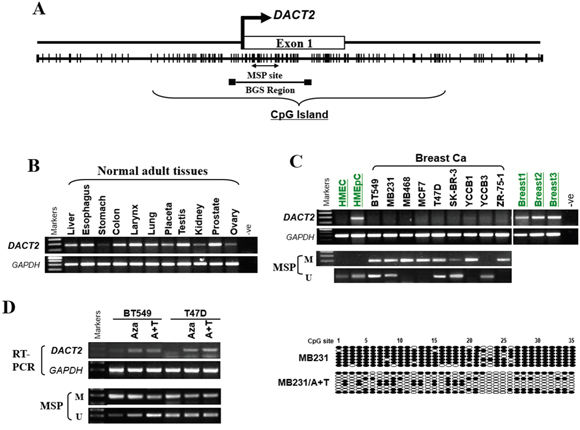 The expression and methylation status of DACT2 in breast cancer cell lines and normal mammary tissues.