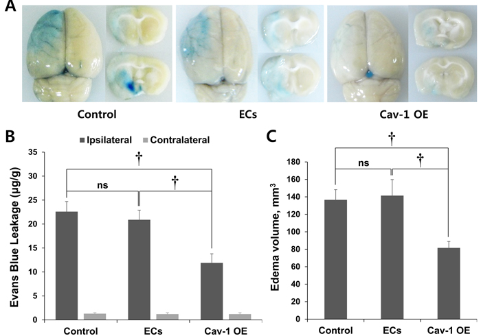 EB staining of control and transplanted wild-type ECs and Cav-1 OE in brain tissues.