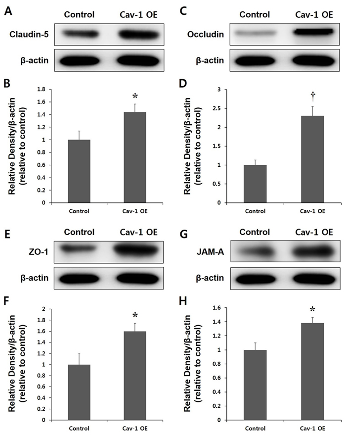 Expression of tight junction (TJ) proteins in the control and Cav-1 overexpression (OE) groups.