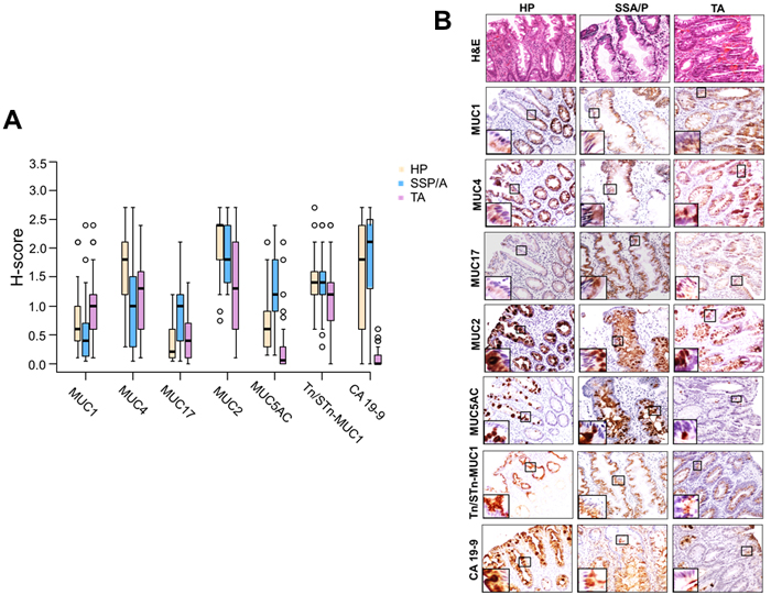 Immunohistochemical expression of mucins and associated O-glycans in colorectal polyps.