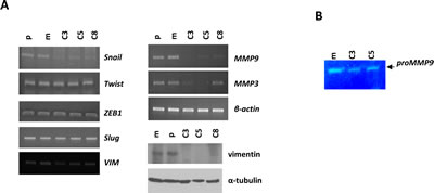 KLK5 expression is associated with suppression of EMTs.