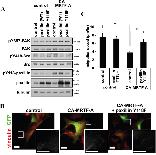Phosphorylation of paxillin is crucial for the CA-MRTF-A-induced phenotypes.