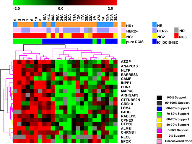 Hierarchical clustering based on the expression profile of the 20 differentially expressed genes in the early stage of DCIS progression (between pure DCIS and the in situ component of DCIS-IBC samples).