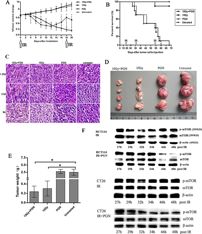 PGN synergizes with bowel irradiation to elicit enhanced antitumor responses in the CT26 model of colorectal cancer.