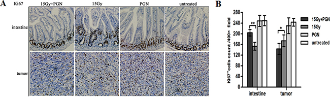 Contrasting effect of PGN treatment on the intestine and tumor following irradiation.