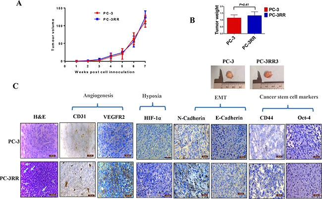 Growth of PC-3 and PC-3RR tumors in vivo and IHC for vasculature, hypoxia, EMT and CSC markers in animal xenografts.