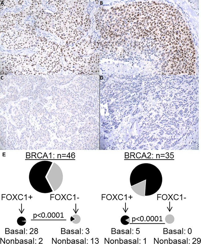 FOXC1 immunohistochemistry, BRCA1/2 mutation status, and molecular subtype.