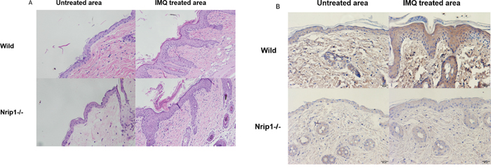 Histology and immunohistochemical (IHC) staining of IMQ treated lesion.