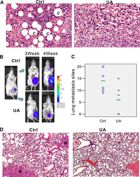 UA inhibits tumor growth and metastasis in vivo.