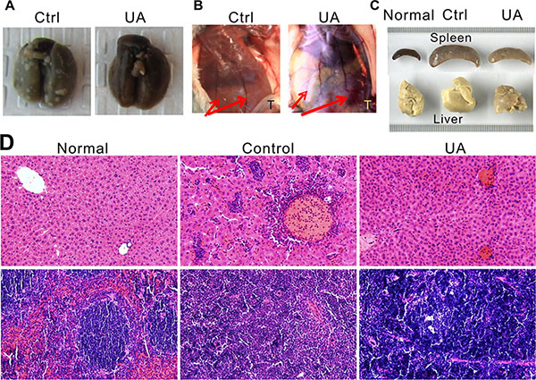 UA suppressed tumor lung metastasis, angiogenesis, leukemoid reaction and extensive extramedullary hematopoiesis of the 4T1 tumor-bearing mice.