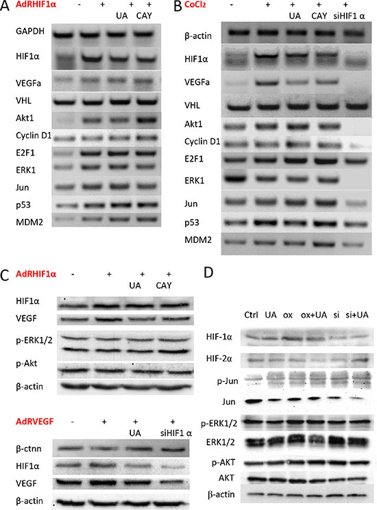Effect of UA on HIF-1&#x03B1; and VEGF expression in breast cancer cells.
