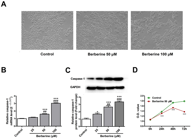 Berberine induces pyroptosis in HepG2 cells.