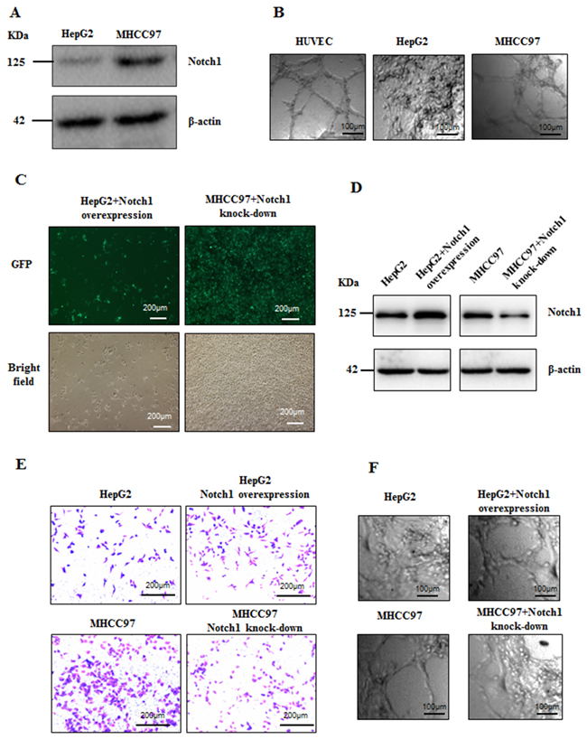 Notch1 associated with invasiveness and VM potentiality of HCC cells.