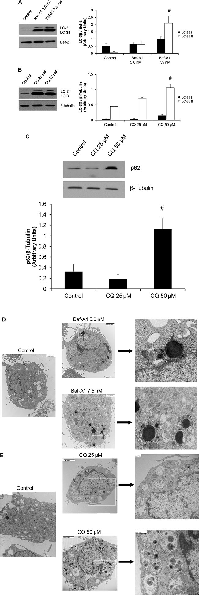 Baf-A1 and CQ treatment inhibits autophagy in P0 cardiac fibroblasts.