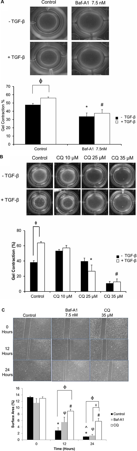 Effect of autophagy inhibition on cellular contractility and migration of P0 cardiac fibroblasts.