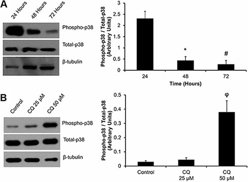 Effect of cell plating and CQ treatment on p38-MAPK phosphorylation in P0 primary cardiac fibroblasts: (Panel A).