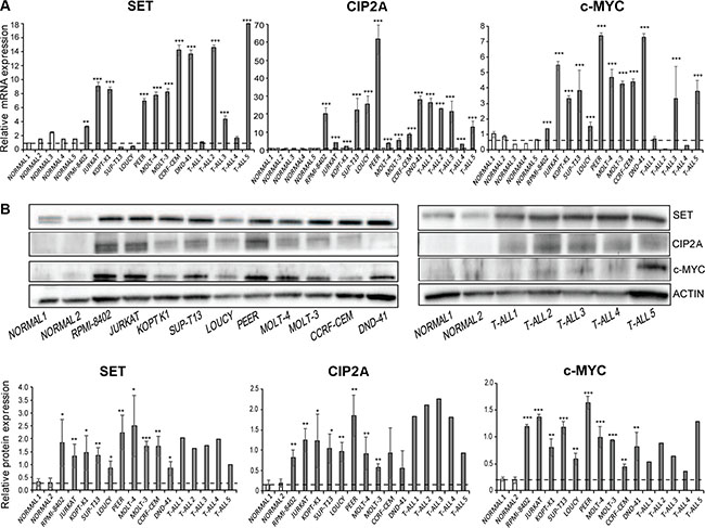 SET and c-MYC are overexpressed in T-ALL cells.