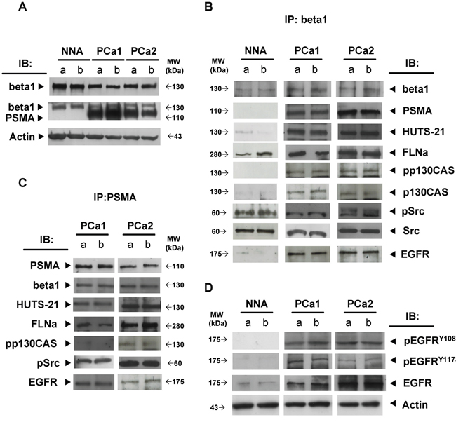 PSMA macromolecular complex is assembled &#x201C;in vivo&#x201D;.